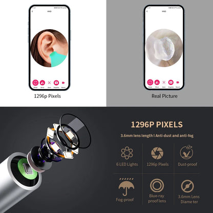 Smart Visual Ear Cleaner with Camera 1296P Ear Sticks USB C Charging Ear Wax Removal Tool WIFI Connection 6 LED Lights Earpick shown displaying clear ear canal images on smartphone and illustrating camera lens features including 1296P pixels and 6 LED lights.